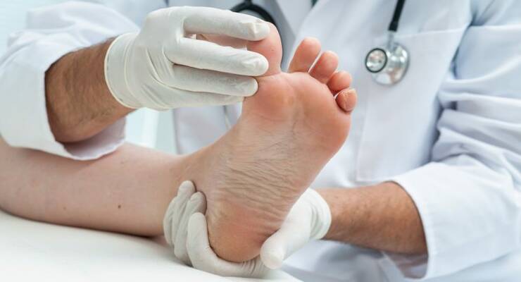 Фото к статье: Как лечить грибок ногтей на ногах
