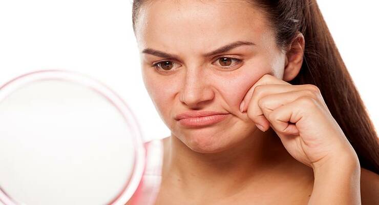 5 способов избавиться от отеков на лице