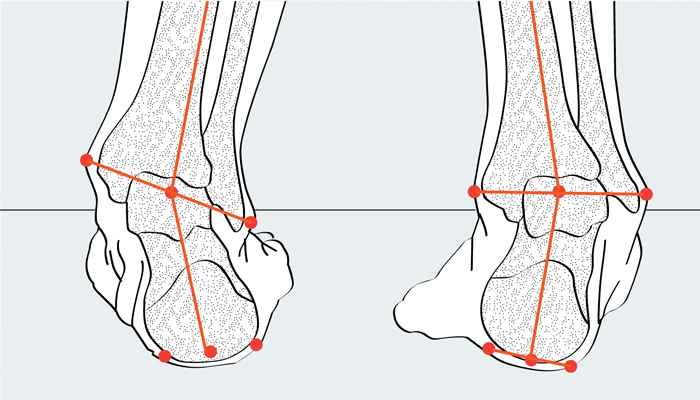 Какие лучше ортопедические стельки чтобы не стаптывалась обувь?