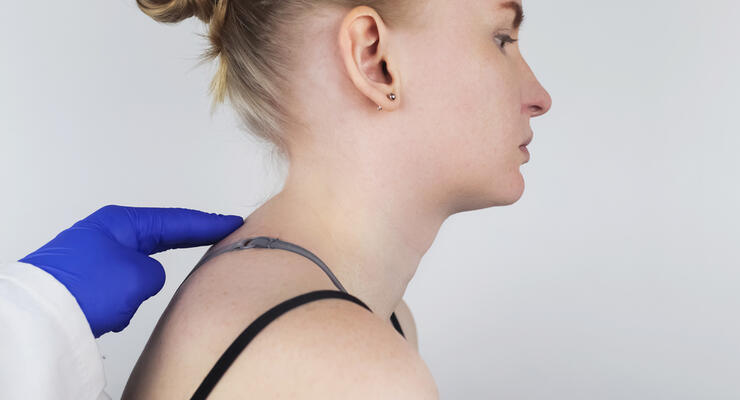 Фото к статье: Как убрать холку на шее: упражнения и процедуры