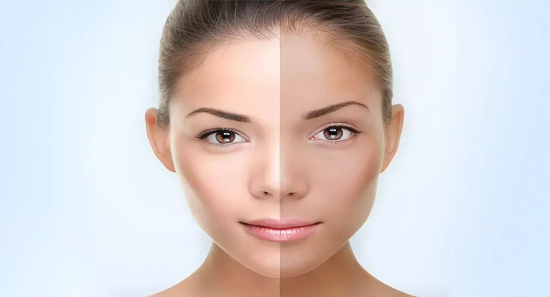Асимметрия: почему одна сторона лица выглядит лучше другой